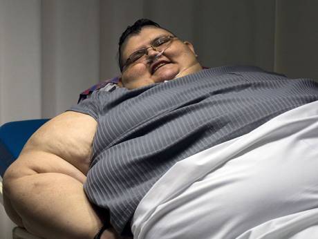 32岁男子重达590公斤 成全球最胖男性